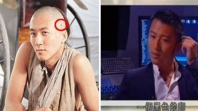 ​谢霆锋患癌是真的吗谢霆锋皮肤癌好了嘛谢霆锋皮肤癌怎么治好