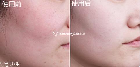 兰芝小白光气垫bb霜使用方法 水光透白的自然妆感 兰芝小白光气垫bb霜使用方法 水光透白的自然妆感