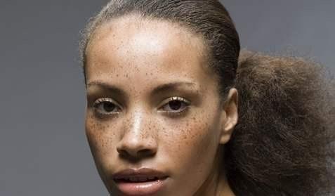 揭露祛斑骗局!别再上当了!