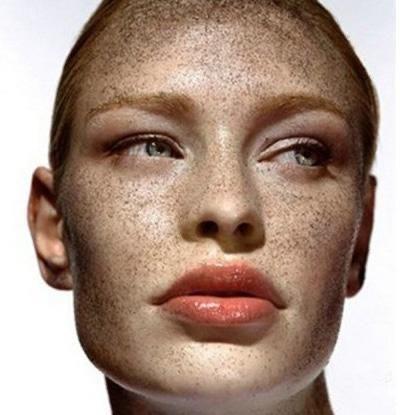 揭露祛斑骗局!别再上当了!