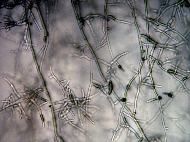 僵尸不一定存在,但僵尸蚂蚁真实存在!这是一种被操控的蚂蚁