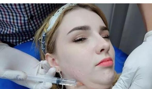 19岁超模红遍全网，自曝整容全过程，从头到脚全是假