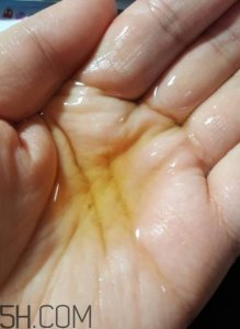 ​法兰琳卡芦荟祛痘面膜有效吗_使用心得