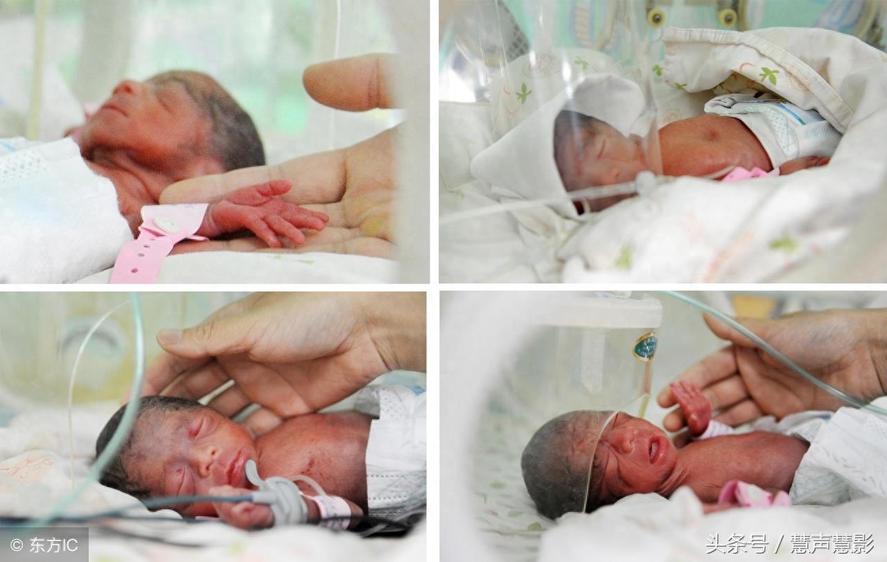四胞胎15图，有人出生只有几百克，四兄弟一起当兵！