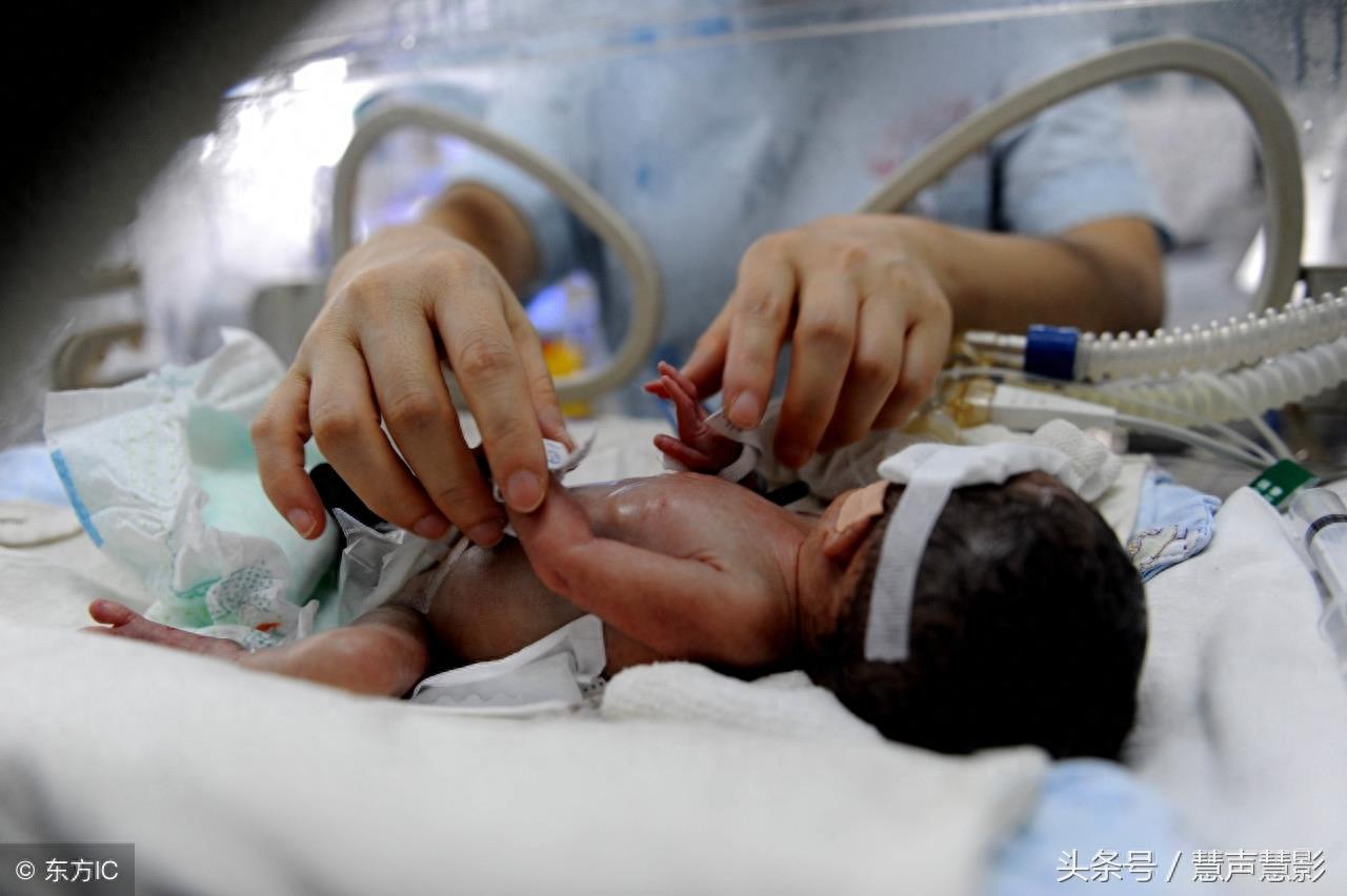 四胞胎15图，有人出生只有几百克，四兄弟一起当兵！