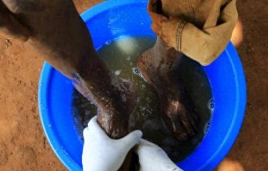 这里的人脚底“千疮百孔”，背后“元凶”让他们痛苦不堪