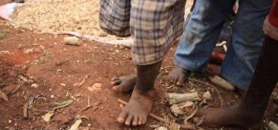 这里的人脚底“千疮百孔”，背后“元凶”让他们痛苦不堪