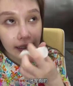 ​赵本山女儿24岁近照：病态整容，骨瘦如柴，网友：越来越像郑爽