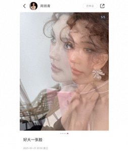 ​周扬青近照变化大，小v脸变小圆脸，网友直呼填充过度太肿了