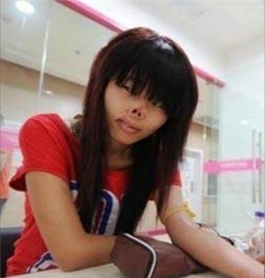 出生28天被老鼠咬掉鼻子的女婴,求职屡碰壁,现生活成这样