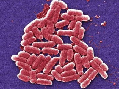 ​美国发现“无敌细菌” 所有抗生素无效