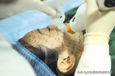 ​皮肤科医生科普热玛吉——操作过程及患者问答，看完就不懵了
