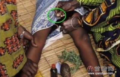 ​割礼是什么意思（解密伊斯兰女性残忍阴蒂割礼 ）