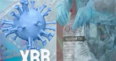 ​感染XBB.1.5是否需要囤纸尿裤