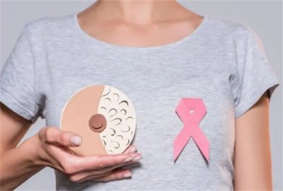 ​乳腺癌药物有哪些 乳腺癌药物难买吗