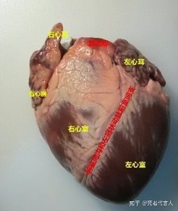 ​房颤中风1——心脏的耳朵