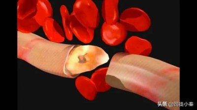 ​血粉是物美价廉的高蛋白饲料