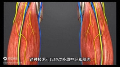 ​脑机接口是什么，对我们生活有什么影响？