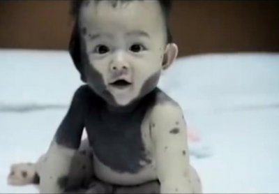 ​2013年，福建女子在孕期吃竹鼠生下“熊猫宝宝”，医生辟谣没关联