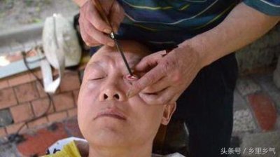 ​农村有一种用刀锋洗眼睛的绝活，没有几个人敢尝试