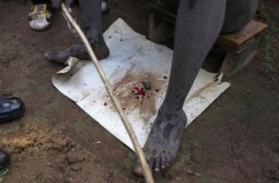 ​非洲割礼是怎么回事（非洲割礼的解释）