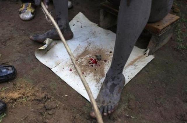 非洲割礼是怎么回事(非洲割礼的解释)