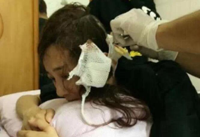 叶璇狗咬事件再度翻出，李依晓近年频繁“换脸”是因为容貌受损？