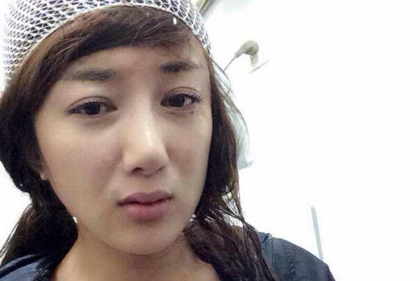 叶璇狗咬事件再度翻出，李依晓近年频繁“换脸”是因为容貌受损？