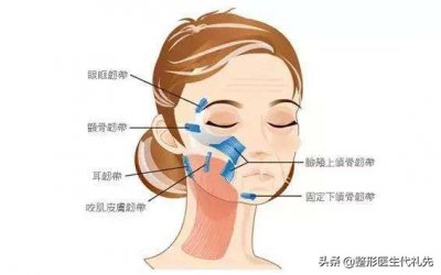 ​中面部提升术 微创小切口面部提升，苹果肌下垂、法令纹明显的姐妹可以看看