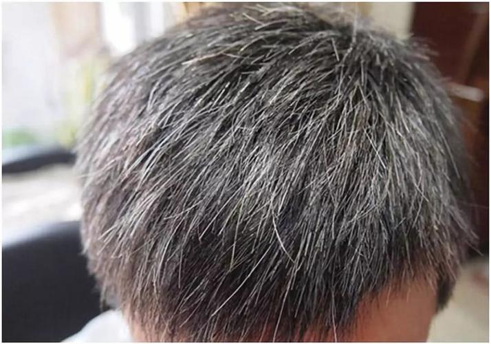 白头发怎样变黑（用上3种方法可能自然变黑）