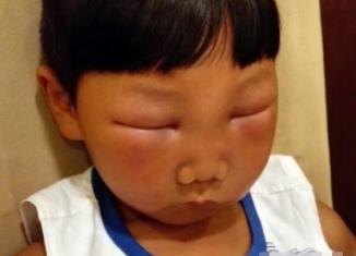 倒霉的狗狗被蜜蜂蛰后 可怜巴巴的样子你见过吗？忍住别笑