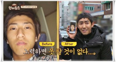 ​黄光熙：关于整容，是母亲给了我勇气