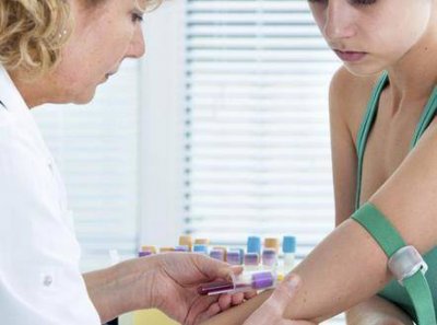 ​性激素六项检查是哪几项 性激素六项检查叫什么