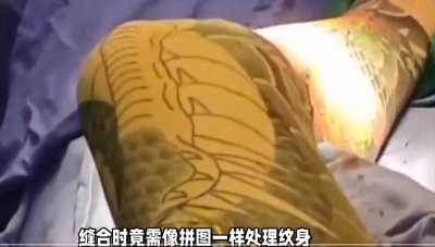 ​医生的“刺青修复挑战”：从“缝龙”到热议