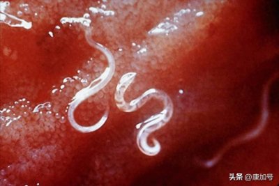 ​致命寄生虫？研究人员警告：犬钩虫的耐药性正在上升