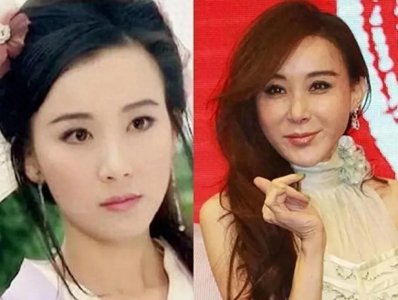 ​你知道整容失败的女性都有谁吗？还真是一个比一个可惜！