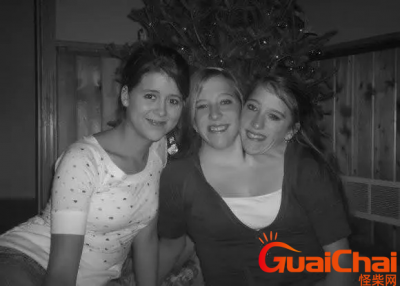 ​畸形人是什么意思?畸形是什么原因导致的?