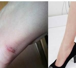 鞋跟磨脚，鞋跟的沿磨脚脖子怎么办？图4