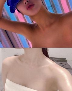 ​皮肤晒黑怎么恢复