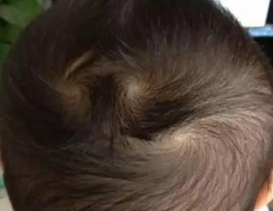 ​小孩头上几个旋有讲究吗(宝宝头顶叫什么)