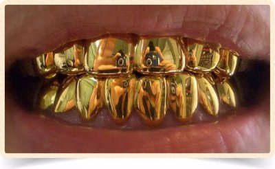 ​看着富贵的金牙为什么现在越来越少人镶了？