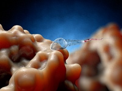 ​捐精过程中护士会额外帮忙吗？男性分享：取精室环境并不色情。