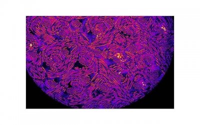 ​新生儿湿疹症状（新生儿湿疹症状图片 初期）