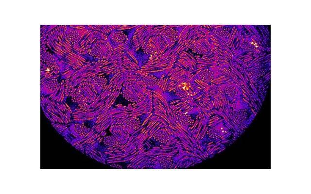 新生儿湿疹症状（新生儿湿疹症状图片 初期）